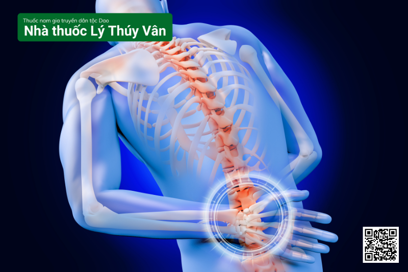 Các Triệu Chứng Của Bệnh Thoái Hóa Cột Sống Lưng