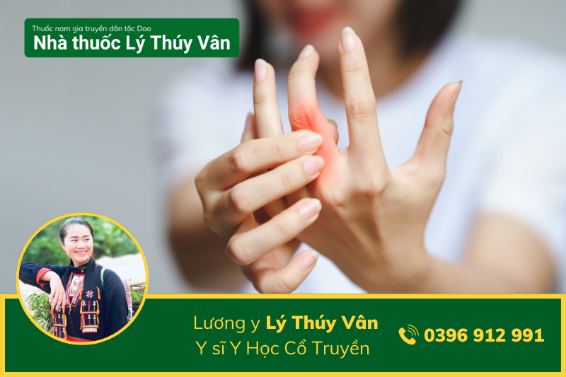 Tìm Hiểu Về Bệnh Viêm Khớp Dạng Thấp Khi Trời Lạnh